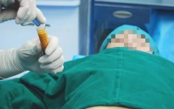 胸部抽脂手術價格探秘,小巷深處的美麗秘密及其費用解析