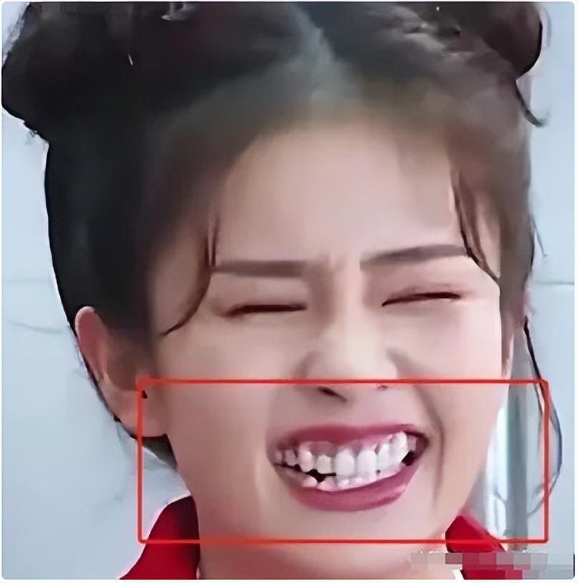 公眾眼中的笑臉明星,微笑魅力閃耀星辰