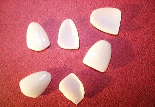 二氧化鋁全瓷牙價格變動與追求自信成就感的關聯(lián)探索